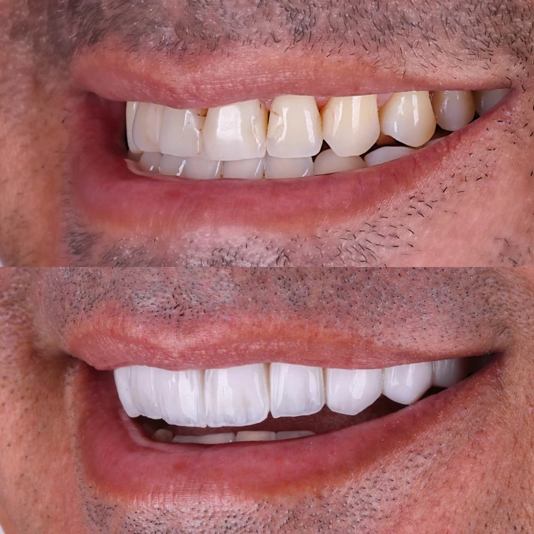 Imagem do antes e depois