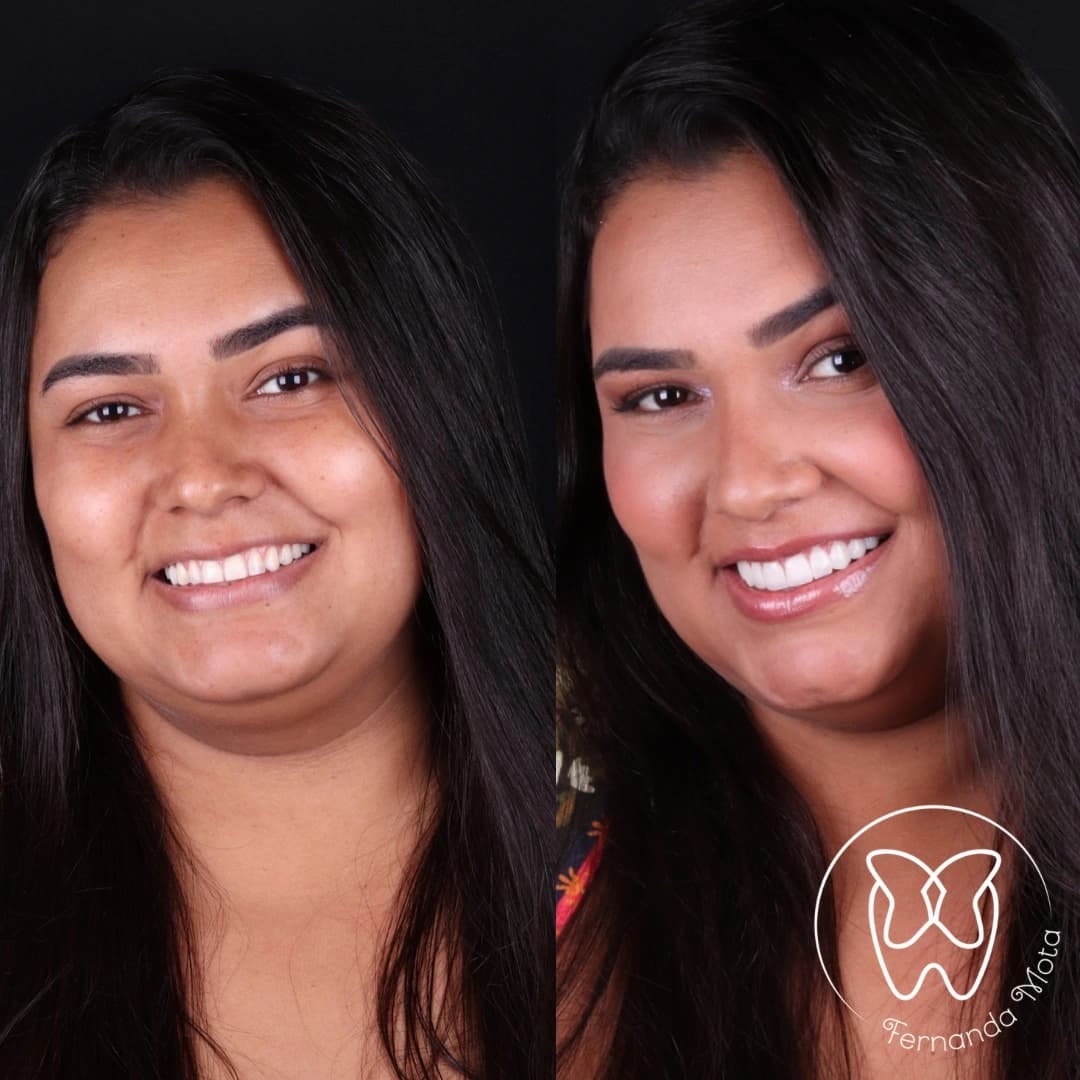 Imagem antes e depois dos nossos clientes