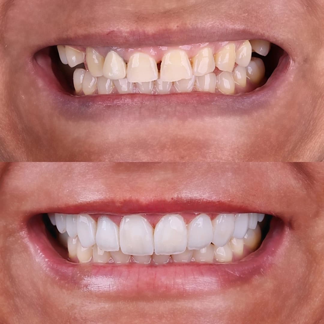 Imagem antes e depois dos nossos clientes