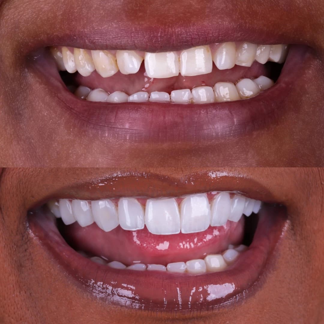 Imagem antes e depois dos nossos clientes