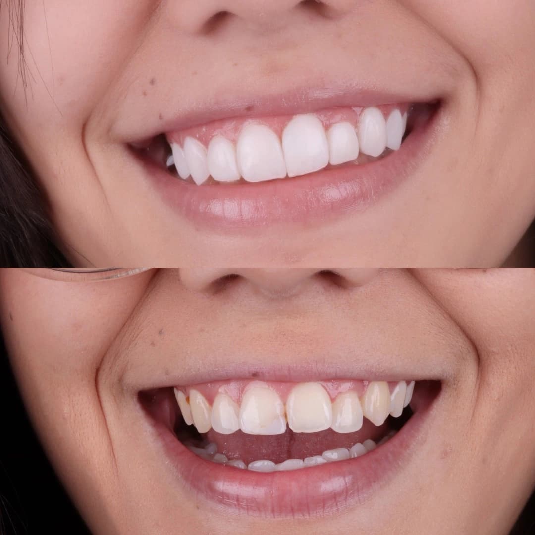 Imagem antes e depois dos nossos clientes