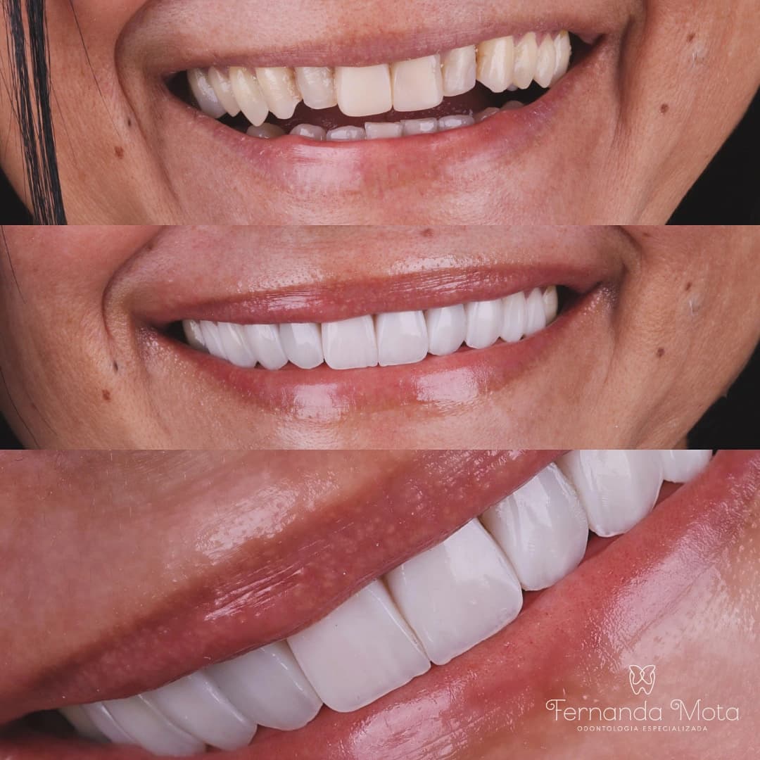 Imagem antes e depois dos nossos clientes