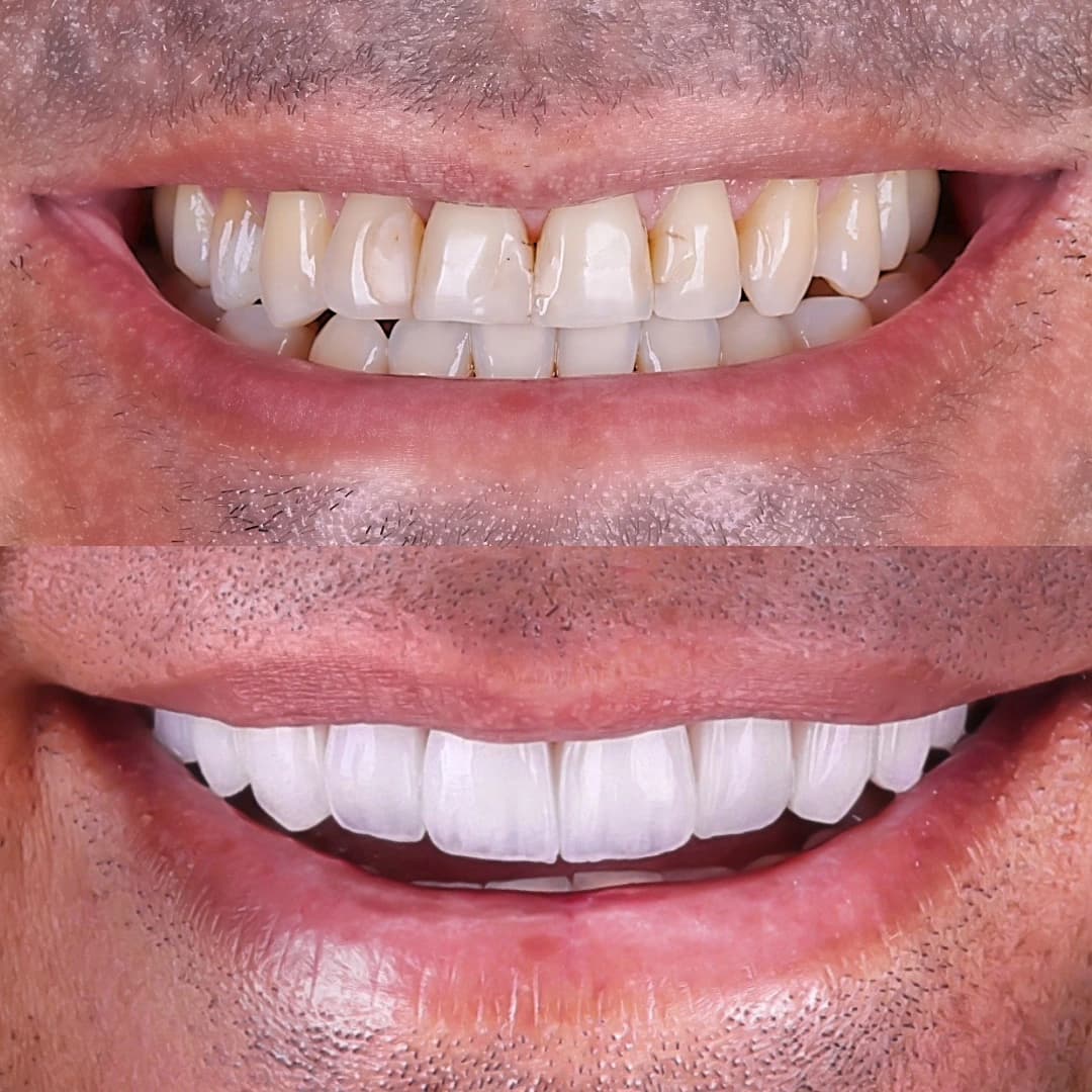 Imagem antes e depois dos nossos clientes