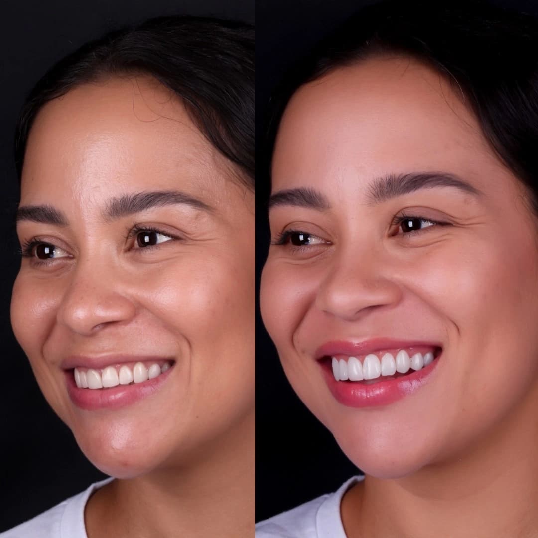 Imagem antes e depois dos nossos clientes