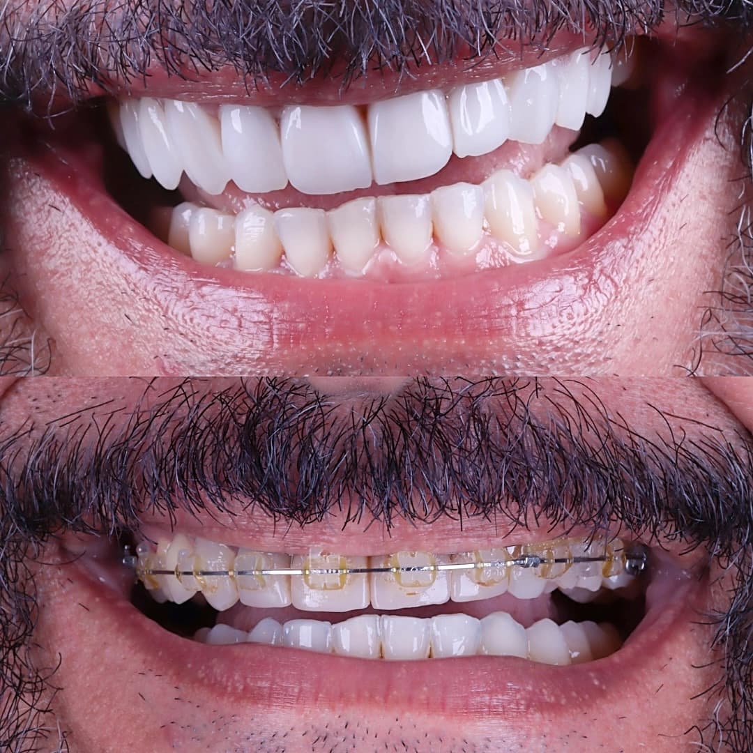 Imagem antes e depois dos nossos clientes