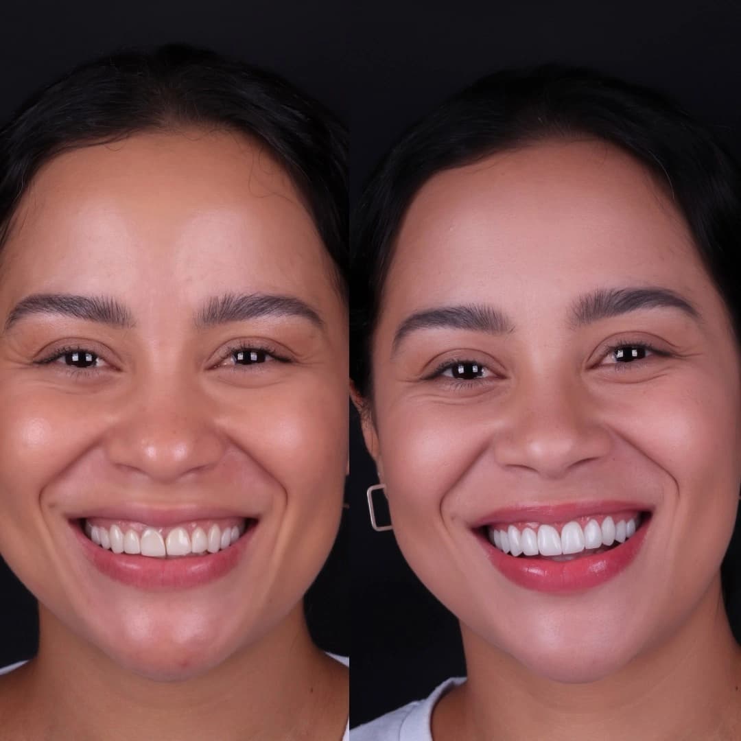 Imagem antes e depois dos nossos clientes